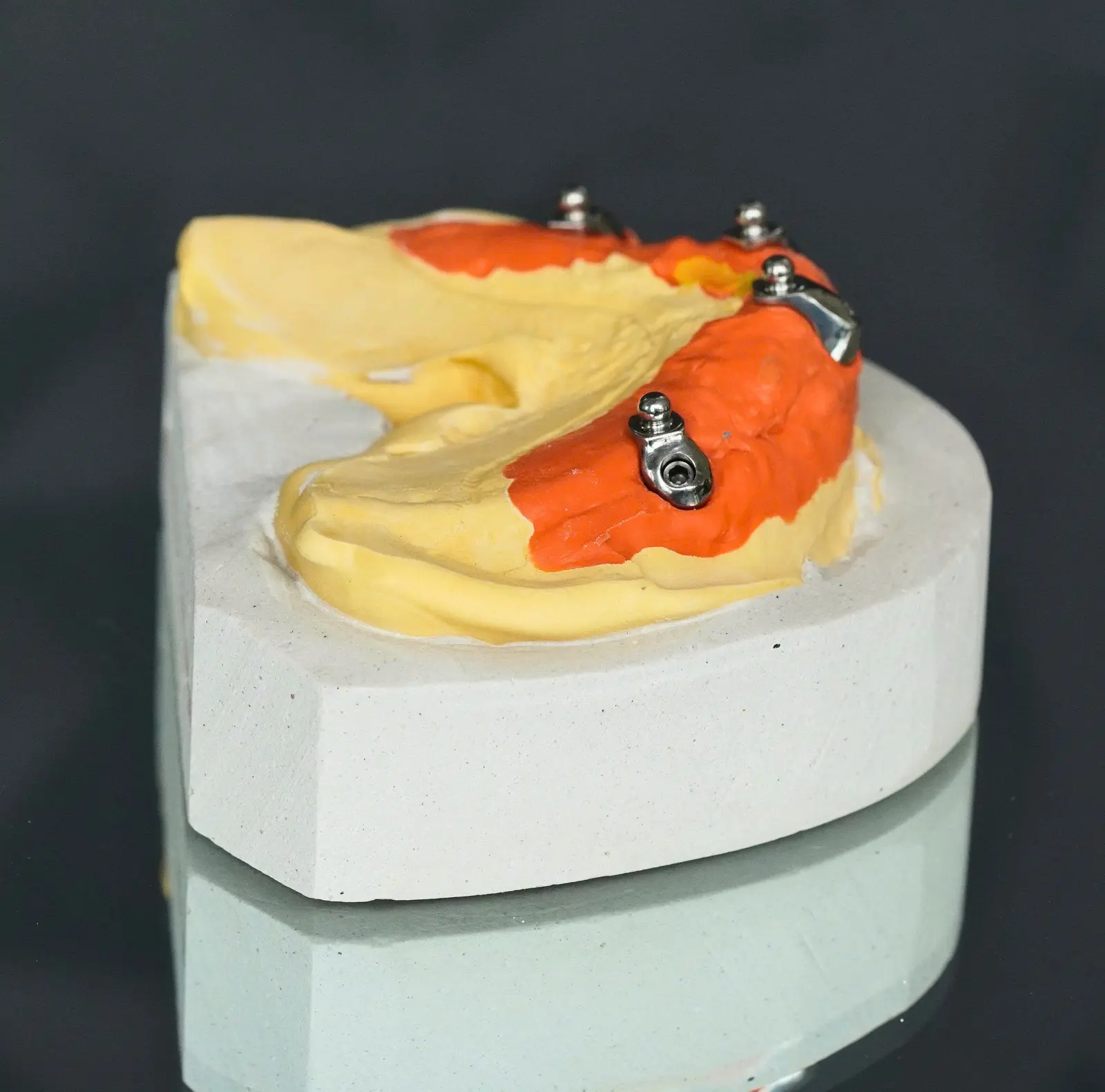 Phục hình tháo lắp trên implant