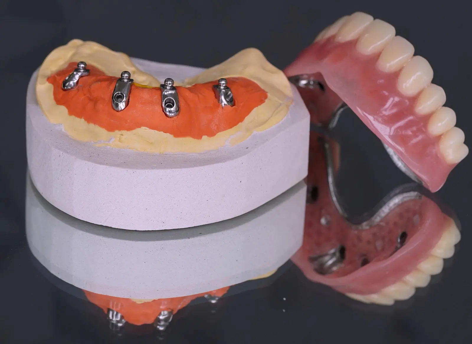 Phục hình tháo lắp trên implant
