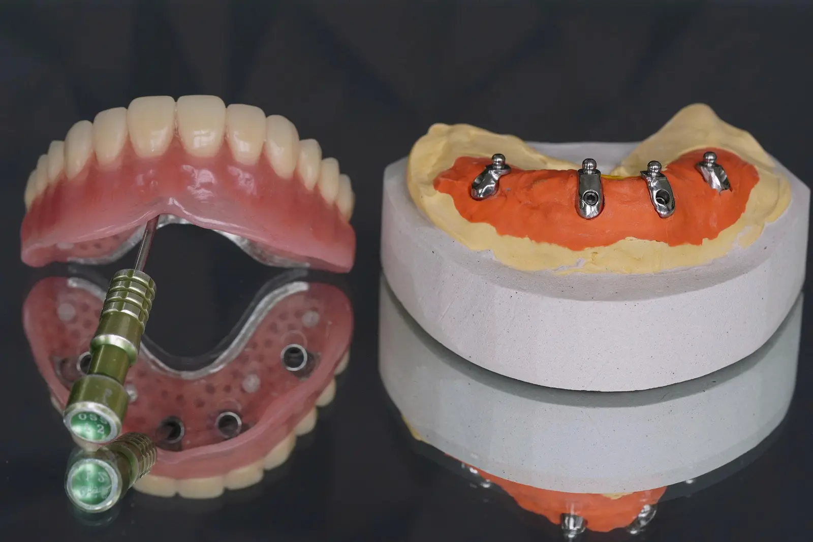 Phục hình tháo lắp trên implant
